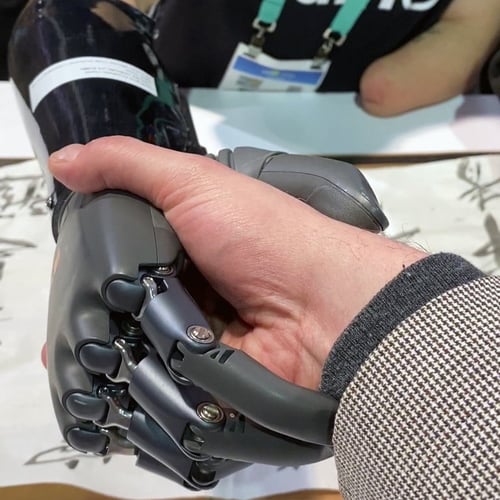 prosthetic arm